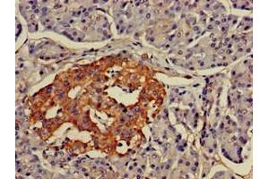 Immunohistochemistry of paraffin-embedded human pancreatic tissue using ABIN7158379 at dilution of 1:100 (LMX1A Antikörper  (AA 9-86))