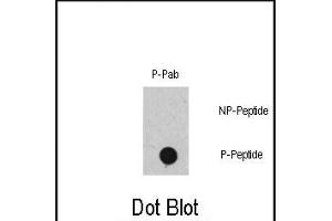 Dot blot analysis of Phospho-RAF1- polyclonal antibody (ABIN389732 and ABIN2839672) on nitrocellulose membrane. (RAF1 Antikörper  (pSer471))