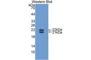 WB of Protein Standard: different control antibodies against Highly purified E. (Haptoglobin ELISA Kit)