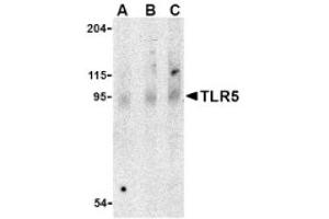 Image no. 1 for anti-Toll-Like Receptor 5 (TLR5) (Middle Region) antibody (ABIN265143) (TLR5 Antikörper  (Middle Region))