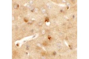 Immunohistochemistry (IHC) image for anti-Coiled-Coil Domain Containing 141 (CCDC141) (N-Term) antibody (ABIN1031303) (CCDC141 Antikörper  (N-Term))
