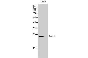 Western Blotting (WB) image for anti-Calcium Binding Protein 7 (CABP7) (N-Term) antibody (ABIN3174122) (CABP7 Antikörper  (N-Term))