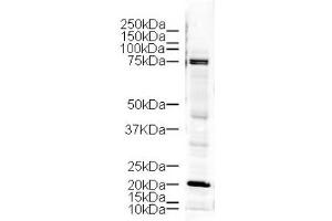 Image no. 1 for anti-LIM Domain Kinase 1 (LIMK1) (AA 630-647) antibody (ABIN401293) (LIM Domain Kinase 1 Antikörper  (AA 630-647))