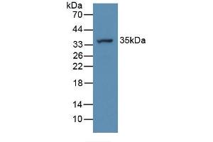 Figure. (ATP6AP2 Antikörper  (AA 18-302))