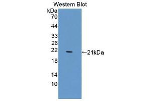 Western blot analysis of the recombinant protein. (PTPN13 Antikörper  (AA 1-161))