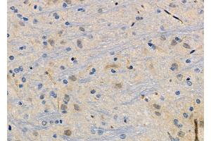 ABIN6266129 and ABIN6272494 at 1/100 staining Rat brain tissue by IHC-P. (ZNF462 Antikörper)