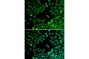 Immunofluorescence analysis of MCF7 cell using RAD9A antibody.