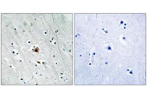 Immunohistochemistry analysis of paraffin-embedded human brain tissue using MAPKAPK2 (Phospho-Ser272) antibody. (MAPKAP Kinase 2 Antikörper  (pSer272))