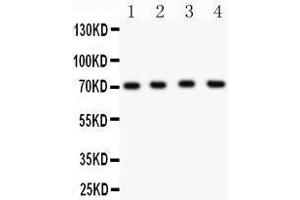 Western Blotting (WB) image for anti-Potassium Voltage-Gated Channel, Shal-Related Subfamily, Member 1 (Kcnd1) (AA 442-647) antibody (ABIN3043268)