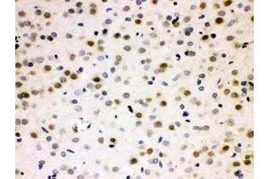 IHC testing of FFPE rat brain with CDC25B antibody. (CDC25B Antikörper  (AA 119-248))