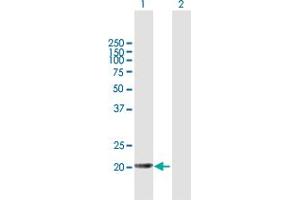 Western Blot analysis of APRT expression in transfected 293T cell line by APRT MaxPab polyclonal antibody.