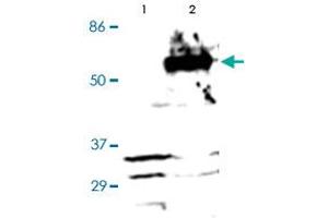 Western Blot (Cell lysate) analysis of (1) Negative control (vector only transfected HEK293 cells), and (2) HEK293 cells transfected with RARA construct.