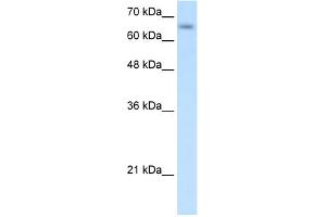 WB Suggested Anti-SLC39A12 Antibody Titration:  0. (SLC39A12 Antikörper  (N-Term))
