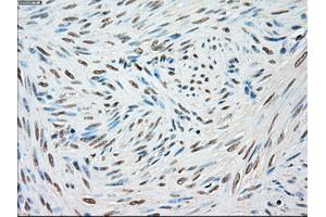 Immunohistochemical staining of paraffin-embedded Kidney tissue using anti-STK3mouse monoclonal antibody.