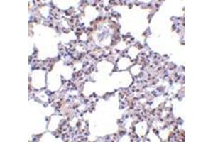 Immunohistochemistry of TRPC6 in mouse lung tissue with this product at 10 μg/ml. (TRPC6 Antikörper  (N-Term))