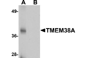 Western blot analysis of TMEM38A in rat skeletal muscle tissue lysate with TMEM38A antibody at 1 µg/mL in (A) the absence and (B) the presence of blocking peptide. (TMEM38A Antikörper  (C-Term))