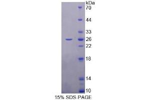 SDS-PAGE (SDS) image for Retinol Binding Protein 3, Interstitial (RBP3) (AA 1027-1229) protein (His tag) (ABIN6238856) (RBP3 Protein (AA 1027-1229) (His tag))