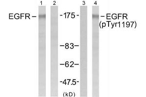 Western blot analysis of extract from A431 cells untreated or treated with EGF (200ng/ml, 5min), using EGFR (Ab-1197) antibody (E021221, Lane1 and 2) and EGFR (phospho-Tyr1197) antibody (E011228, Lane 3 and 4). (EGFR Antikörper)