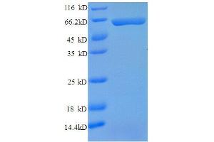 SDS-PAGE (SDS) image for Carbonic Anhydrase IX (CA9) (AA 64-399), (partial) protein (GST tag) (ABIN1046758) (CA9 Protein (AA 64-399, partial) (GST tag))