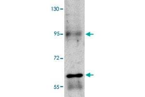 Western blot analysis of RUSC1 in A-20 cell lysate with RUSC1 polyclonal antibody  at 1 ug/mL . (RUSC1 Antikörper  (C-Term))