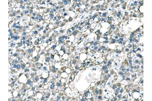 IHC analysis of B Raf/BRAF using anti-B Raf/BRAF antibody (ABIN3043761). (BRAF Antikörper  (AA 38-230))