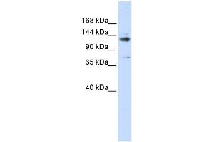 WB Suggested Anti-GTF2I Antibody Titration: 0. (GTF2I Antikörper  (Middle Region))