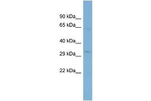 WB Suggested Anti-TMEM110  Antibody Titration: 0. (TMEM110 Antikörper  (N-Term))