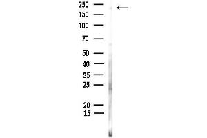 Western blot analysis of lysates from Hela cells, using TRPM7 Antibody at 1/1000 dilution.