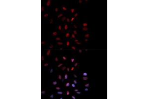 Immunofluorescence analysis of MCF7 cell using Phospho-FOS-T232 antibody. (c-FOS Antikörper  (pThr232))