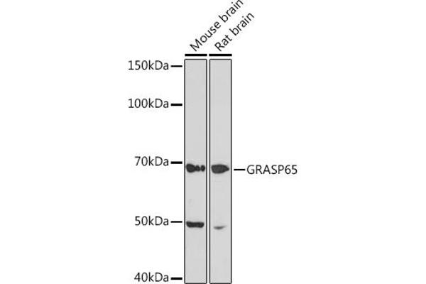 GORASP1 Antikörper