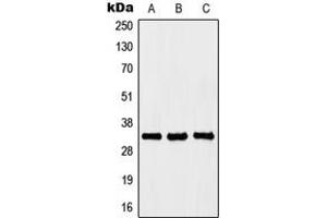 Western blot analysis of HOXB4 expression in Jurkat (A), K562 (B), PC12 (C) whole cell lysates. (HOXB4 Antikörper  (Center))