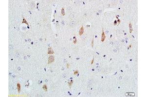 Formalin-fixed and paraffin embedded rat brain tissue labeled with Rabbit Anti-NGF-beta Polyclonal Antibody  at 1:200 followed by conjugation to the secondary antibody and DAB staining. (NGFB Antikörper  (AA 151-220))