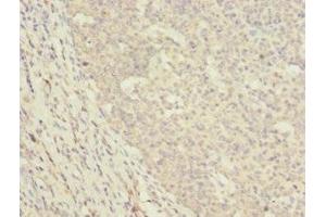 Immunohistochemistry (IHC) image for anti-DnaJ (Hsp40) Homolog, Subfamily A, Member 2 (DNAJA2) (AA 233-412) antibody (ABIN7150497)