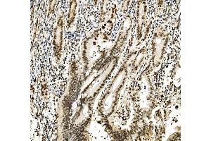 IHC analysis of RCC1 using anti-RCC1 antibody (ABIN7600024).