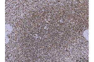 IHC analysis of PC4/SUB1 using anti-PC4/SUB1 antibody (ABIN7602185). (SUB1 Antikörper  (AA 62-127))