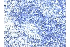 Cells treated with a phosphatase to eliminate all phosphorylation (LAT Antikörper  (pTyr226))