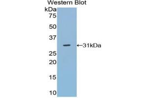 Western blot analysis of the recombinant protein. (TRADD Antikörper  (AA 21-259))
