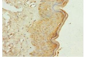 Immunohistochemistry of paraffin-embedded human skin tissue using ABIN7163882 at dilution of 1:100 (GALNT3 Antikörper  (AA 1-140))