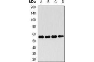 Western blot analysis of FKBP4 expression in Hela (A), Jurkat (B), MCF7 (C), mouse testis (D) whole cell lysates. (FKBP4 Antikörper)