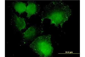 Immunofluorescence of monoclonal antibody to CNOT7 on HeLa cell. (CNOT7 Antikörper  (AA 1-285))