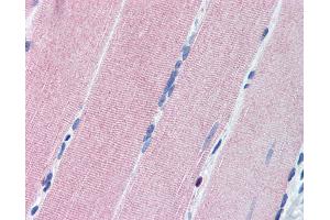 Immunohistochemistry (IHC) image for anti-Protein Kinase, CGMP-Dependent, Type I (PRKG1) (AA 657-671) antibody (ABIN307178)