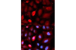 Immunofluorescence analysis of U2OS cells using PDLIM5 antibody. (PDLIM5 Antikörper  (AA 317-596))
