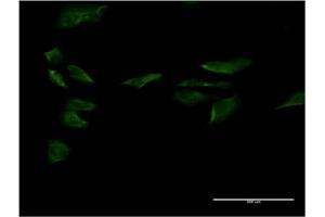 Immunofluorescence of monoclonal antibody to SP1 on HeLa cell. (SP1 Antikörper  (AA 522-618))