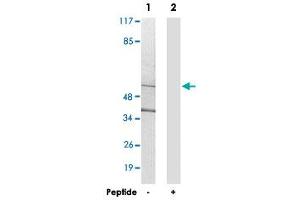 Western blot analysis of extracts from 293 cells, using CYP21A2 polyclonal antibody . (CYP21A2 Antikörper)