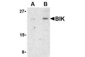 Western blot analysis of BIK in Jurkat cell lysate with AP30150PU-N BIK antibody at (A) 1 and (B) 2 μg/ml.