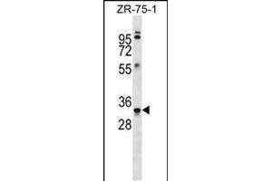 MBP Antibody (Ascites) ABIN1539854 western blot analysis in ZR-75-1 cell line lysates (35 μg/lane). (MBP Antikörper)
