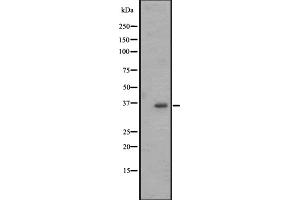 Western blot analysis of OR2M4 expression in Jurkat whole cell lysate ,The lane on the left is treated with the antigen-specific peptide. (OR2M4 Antikörper)