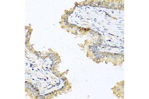 Immunohistochemistry of paraffin-embedded human prostate using DEFB121 antibody at dilution of 1:100 (40x lens). (DEFB121 Antikörper)