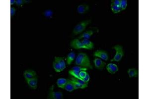 Immunofluorescence staining of MCF-7 cells with ABIN7174125 at 1:133, counter-stained with DAPI. (SIRPA Antikörper  (AA 31-373))