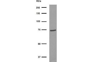 Western blot analysis of FOXJ3 Antibody expression in HepG2 cells lysates. (FOXJ3 Antikörper  (C-Term))
